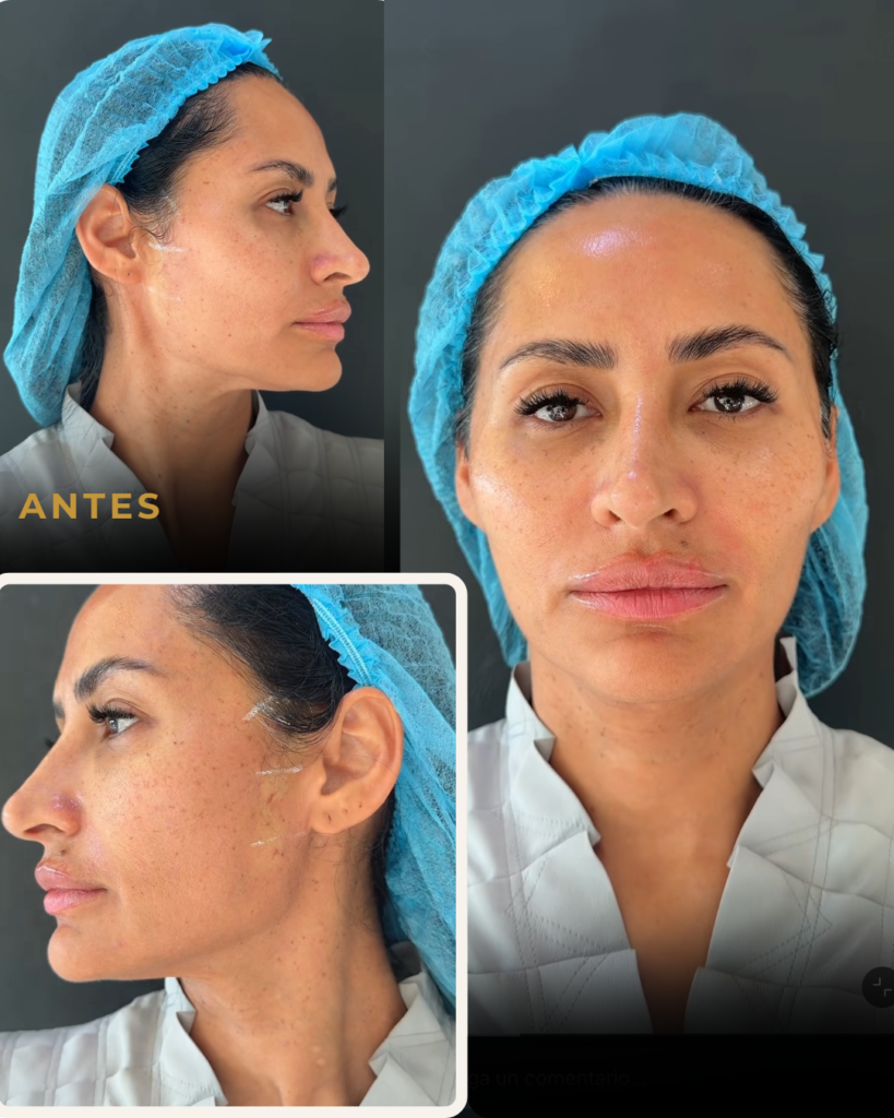 BABY-FACE-ANTES-DRA-CAMI-MARTINEZ-BOGOTA