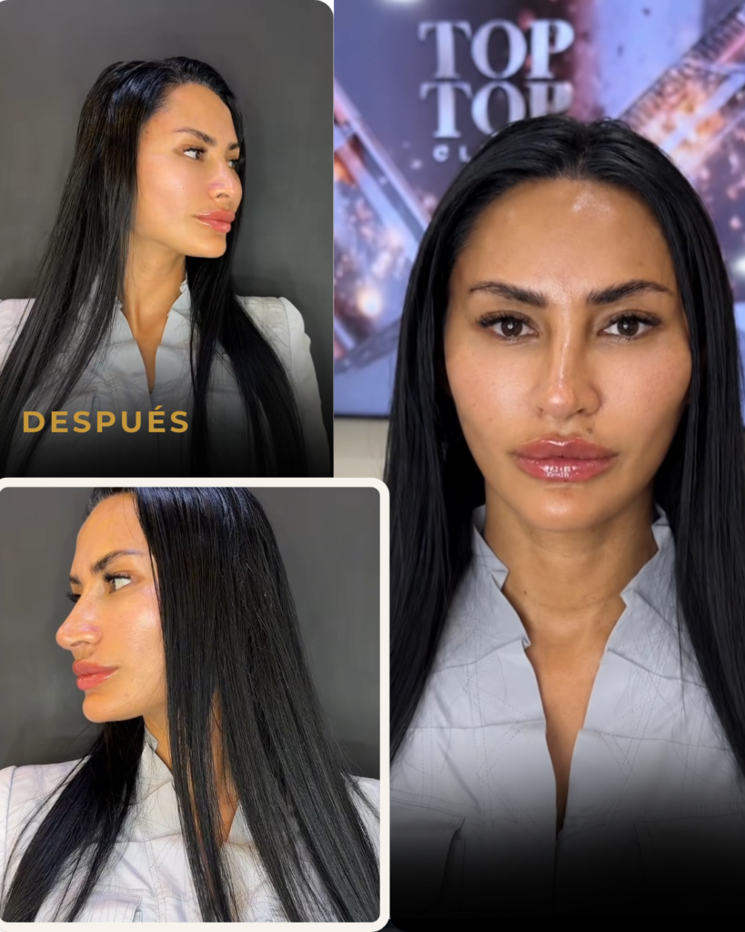 BABY-FACE-DESPUES-DRA-CAMI-MARTINEZ-BOGOTA